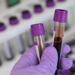 Ergebnisse zu den Landesprogrammen PRRS und Salmonellen-Monitoring